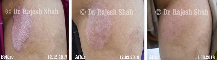 lifeforce homeopathy case-photos